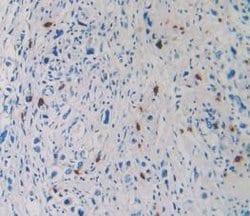 Invitrogen Tryptase Monoclonal Antibody (C16) 200 &mu;L; Unconjugated:Antibodies,