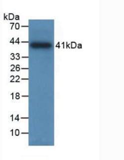 Invitrogen Tryptase Monoclonal Antibody (C16) 200 &mu;L; Unconjugated:Antibodies,
