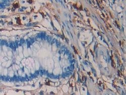 Invitrogen Tryptase Monoclonal Antibody (C10) 20 &mu;L; Unconjugated:Antibodies,