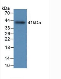 Invitrogen Tryptase Monoclonal Antibody (C10) 20 &mu;L; Unconjugated:Antibodies,