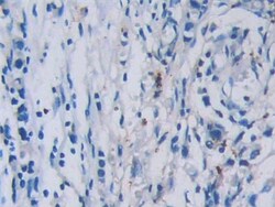 Invitrogen Tryptase Monoclonal Antibody (C10):Antibodies:Primary Antibodies