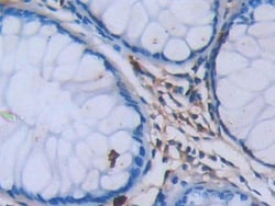 Invitrogen Tryptase Monoclonal Antibody (C10):Antibodies:Primary Antibodies