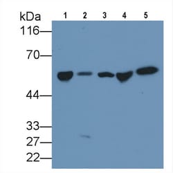 Invitrogen GC Monoclonal Antibody (C4) 200 &mu;L | Buy Online | Invitrogen&trade; | Fisher Scientific