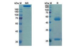 Invitrogen Matuzumab Humanized Recombinant Human Monoclonal Antibody 100