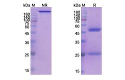 Invitrogen Epratuzumab Humanized Recombinant Human Monoclonal Antibody 100 &mu;g | Buy Online | Invitrogen&trade; | Fisher Scientific