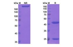 Invitrogen Cantuzumab Humanized Recombinant Human Monoclonal Antibody 100