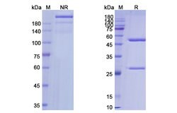 Invitrogen Labetuzumab Humanized Recombinant Human Monoclonal Antibody 100 &mu;g | Buy Online | Invitrogen&trade; | Fisher Scientific