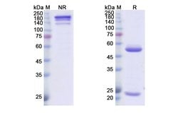 Amatuximab Chimeric Recombinant Human Monoclonal Antibody:Antibodies, Recombinant