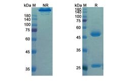 Invitrogen Motavizumab Humanized Recombinant Human Monoclonal Antibody
