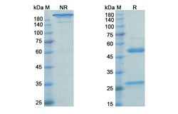 Invitrogen Pertuzumab Humanized Recombinant Human Monoclonal Antibody 100