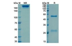 Invitrogen Sevirumab Humanized Recombinant Human Monoclonal Antibody 100