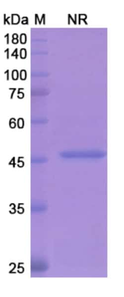 Invitrogen Ranibizumab Humanized Recombinant Human Monoclonal Antibody 100 &mu;g | Buy Online | Invitrogen&trade; | Fisher Scientific
