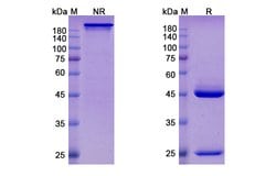 Invitrogen Felvizumab Humanized Recombinant Human Monoclonal Antibody 100 &mu;g | Buy Online | Invitrogen&trade; | Fisher Scientific