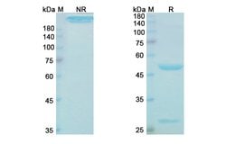 Invitrogen Gevokizumab Humanized Recombinant Human Monoclonal Antibody