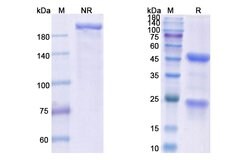 Invitrogen 14F7 Recombinant Mouse Monoclonal Antibody 100 &mu;g; Unconjugated:Anticorps,