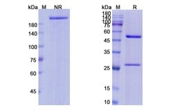 Invitrogen Edrecolomab Recombinant Mouse Monoclonal Antibody 100 &mu;g | Buy Online | Invitrogen&trade; | Fisher Scientific