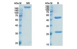 Invitrogen Enlimomab Recombinant Mouse Monoclonal Antibody 100 &mu;g; Unconjugated:Antibodies,