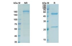 Invitrogen Mitumomab Recombinant Mouse Monoclonal Antibody 100 &mu;g; Unconjugated:Antibodies,