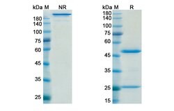 Invitrogen Muromonab Recombinant Mouse Monoclonal Antibody 100 &mu;g | Buy Online | Invitrogen&trade; | Fisher Scientific