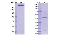 Invitrogen Nofetumomab Recombinant Mouse Monoclonal Antibody 100 &mu;g;