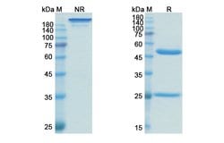 Invitrogen Oregovomab Recombinant Mouse Monoclonal Antibody 100 &mu;g;