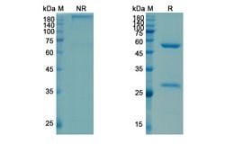 Invitrogen Satumomab Recombinant Mouse Monoclonal Antibody 100 &mu;g | Buy Online | Invitrogen&trade; | Fisher Scientific