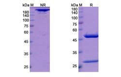 Invitrogen cT84.66 Chimeric Recombinant Human Monoclonal Antibody 100 &mu;g;