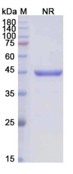 Invitrogen Abciximab Chimeric Recombinant Human Monoclonal Antibody 100 &mu;g | Buy Online | Invitrogen&trade; | Fisher Scientific