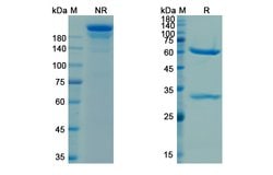 Invitrogen Cetuximab Chimeric Recombinant Human Monoclonal Antibody 100 &mu;g | Buy Online | Invitrogen&trade; | Fisher Scientific