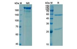 Invitrogen Briakinumab Recombinant Human Monoclonal Antibody 100 &mu;g;