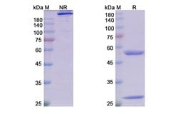 Invitrogen Adecatumumab Recombinant Human Monoclonal Antibody 100 &mu;g;