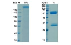 Invitrogen Ganitumab Recombinant Human Monoclonal Antibody 100 &mu;g; Unconjugated:Antibodies,