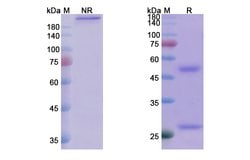 Invitrogen Tuvirumab Recombinant Human Monoclonal Antibody 100 &mu;g | Buy Online | Invitrogen&trade; | Fisher Scientific