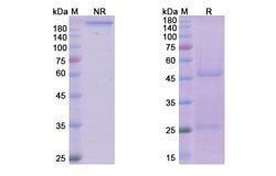 Invitrogen Tralokinumab Recombinant Human Monoclonal Antibody 100 &mu;g | Buy Online | Invitrogen&trade; | Fisher Scientific