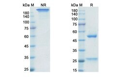 Invitrogen Golimumab Recombinant Human Monoclonal Antibody 100 &mu;g; Unconjugated:Antibodies,