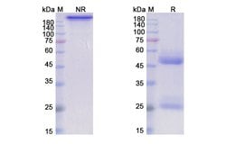 Invitrogen Humax-Il15 Recombinant Human Monoclonal Antibody 100 &mu;g | Buy Online | Invitrogen&trade; | Fisher Scientific