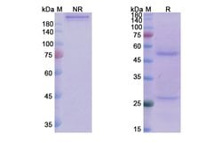Invitrogen J695 Humanized Recombinant Human Monoclonal Antibody 100 &mu;g | Buy Online | Invitrogen&trade; | Fisher Scientific