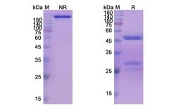 Invitrogen Mapatumumab Recombinant Human Monoclonal Antibody 100 &mu;g;