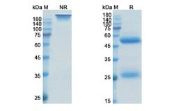 Invitrogen Otilimab Recombinant Human Monoclonal Antibody 100 &mu;g; Unconjugated:Anticorps,