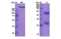 Invitrogen MOR202 Recombinant Human Monoclonal Antibody 100 &mu;g; Unconjugated:Antibodies,