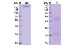 Invitrogen Ofatumumab Recombinant Human Monoclonal Antibody 100 &mu;g;