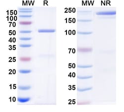 Invitrogen OST 577 Recombinant Human Monoclonal Antibody 100 &mu;g | Buy Online | Invitrogen&trade; | Fisher Scientific