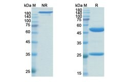 Invitrogen Zanolimumab Recombinant Human Monoclonal Antibody 100 &mu;g;