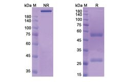 Invitrogen CMB-401 Recombinant Human Monoclonal Antibody 100 &mu;g | Buy Online | Invitrogen&trade; | Fisher Scientific