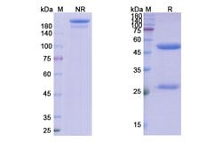 Invitrogen CDP571 Recombinant Human Monoclonal Antibody 100 &mu;g; Unconjugated:Antibodies,