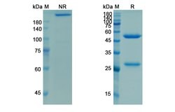Invitrogen Racotumomab Recombinant Mouse Monoclonal Antibody 100 &mu;g;