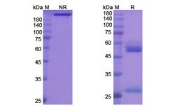 Invitrogen Tremelimumab Recombinant Human Monoclonal Antibody 100 &mu;g | Buy Online | Invitrogen&trade; | Fisher Scientific