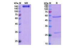 Invitrogen Denosumab Recombinant Human Monoclonal Antibody 100 &mu;g; Unconjugated:Antibodies,