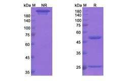 Invitrogen Bapineuzumab Humanized Recombinant Human Monoclonal Antibody 100 &mu;g | Buy Online | Invitrogen&trade; | Fisher Scientific