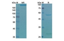 Invitrogen Tucotuzumab Humanized Recombinant Human Monoclonal Antibody